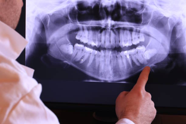 Best Tooth Pain Emergency Relief  in Montgomeryville, PA
